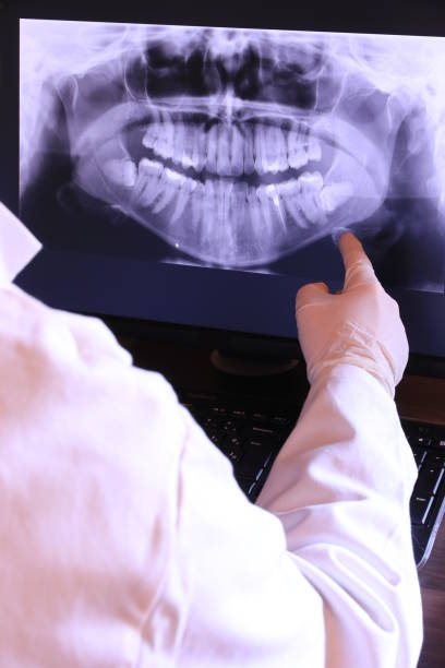 Best Emergency Dental Care for Abscessed Tooth in George West, TX
